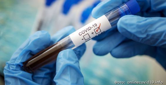 Более 300 жителей Чукотки протестировали на антитела к COVID-19